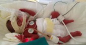 Foto5cpap_R
