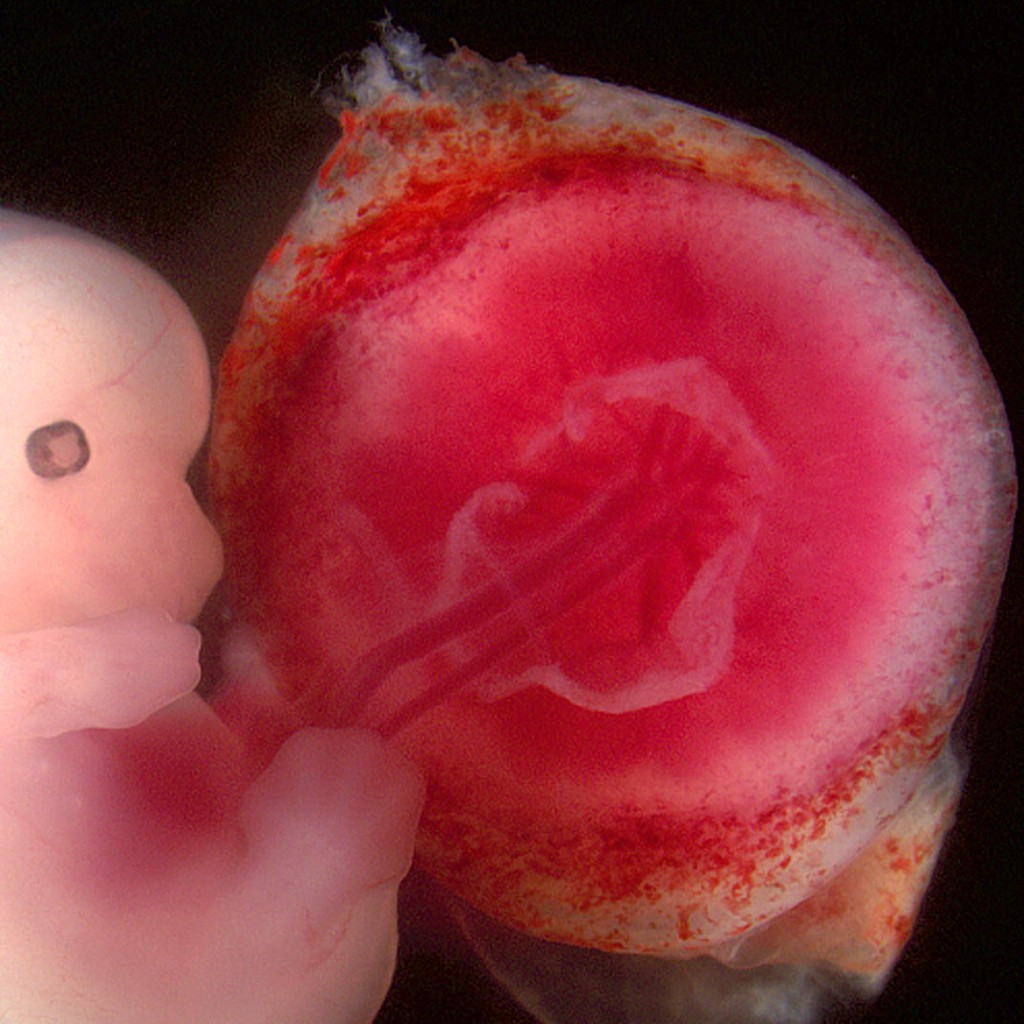 placenta e cordone ombelicale